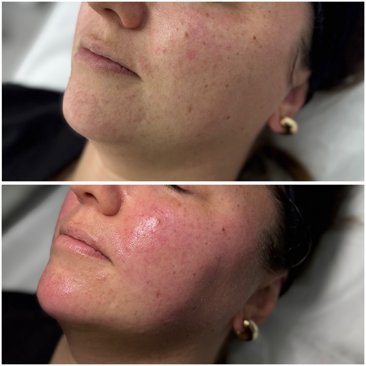 Zdjęcie z Instagrama - Kosmetologia Estetyczna Kinga Brzyzek