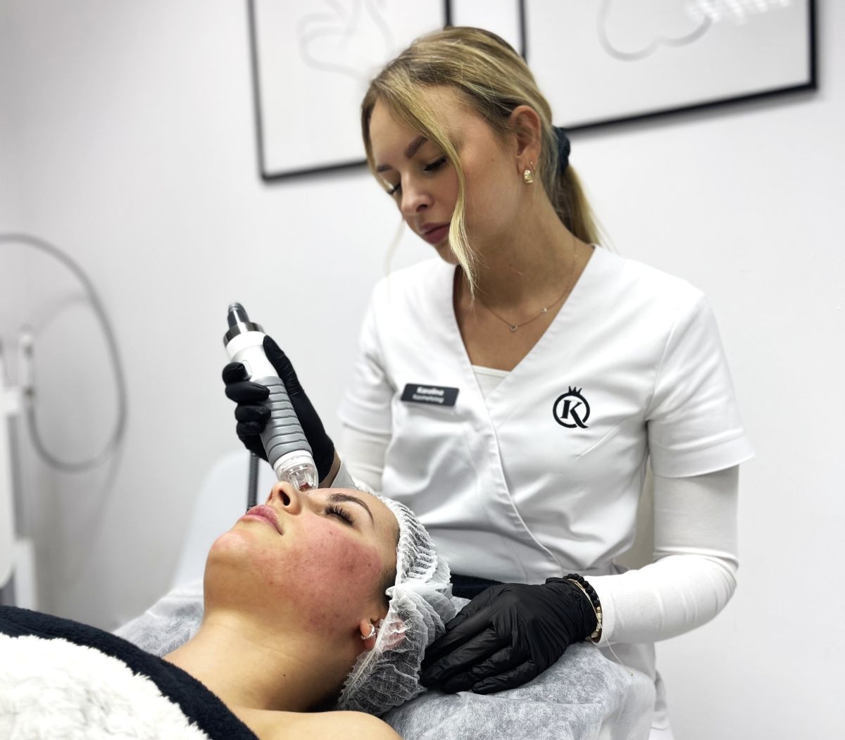 Blizny i przebarwienia po trądziku – jak odbudować skórę i wyrównać jej koloryt?